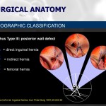 Diapositiva05